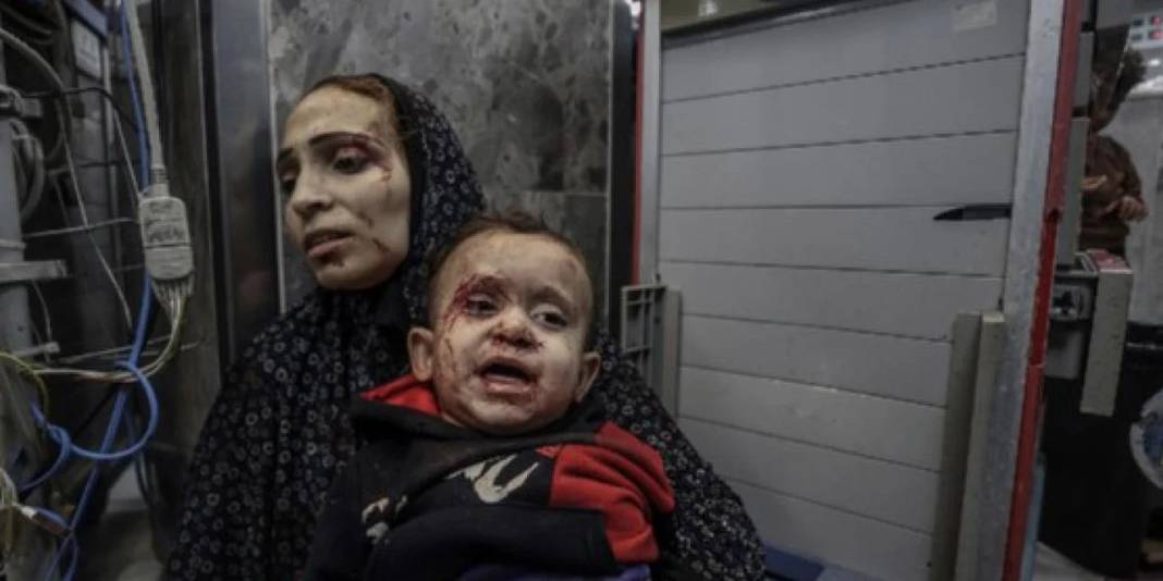 Gazze’de insanlığı utandıran fotoğraflar 1