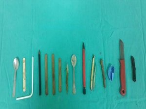 Midesinden 16 parça çıktı