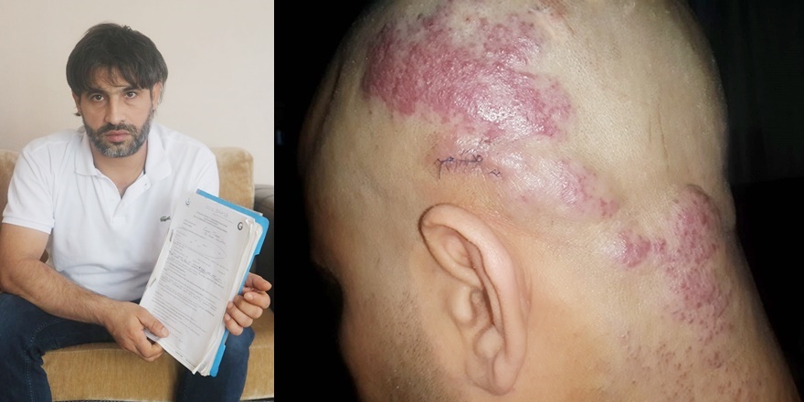 18 yıldır teşhis edilemeyen hastalık