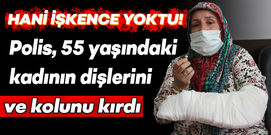 VİDEO - Diyarbakır’da polis 55 yaşındaki kadının dişlerini ve kolunu kırdı