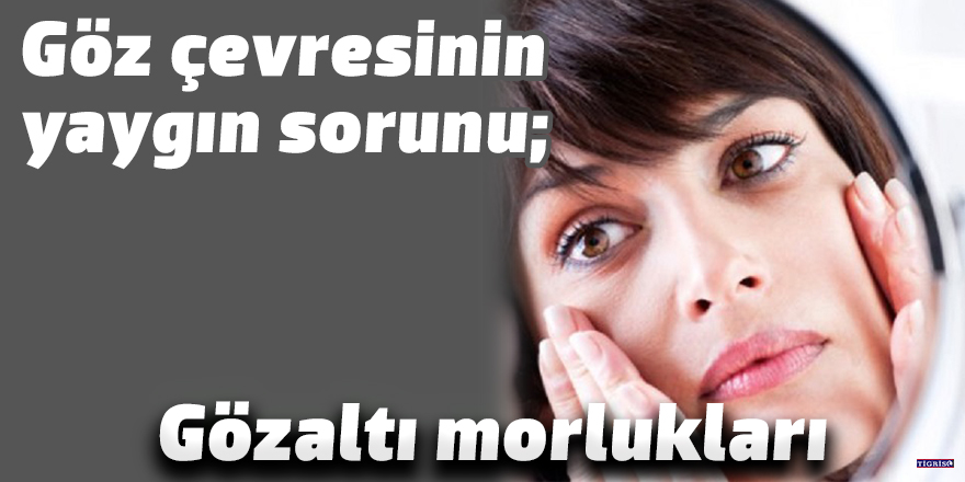 Göz çevresinin yaygın sorunu: Gözaltı morlukları