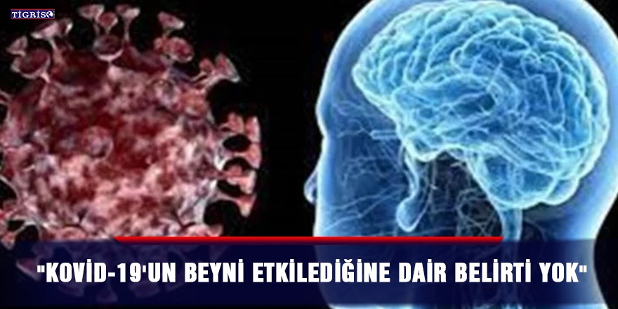 "Kovid-19'un beyni etkilediğine dair belirti yok"