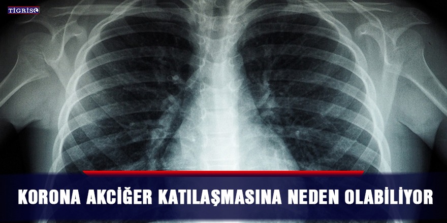 Korona akciğer katılaşmasına neden olabiliyor