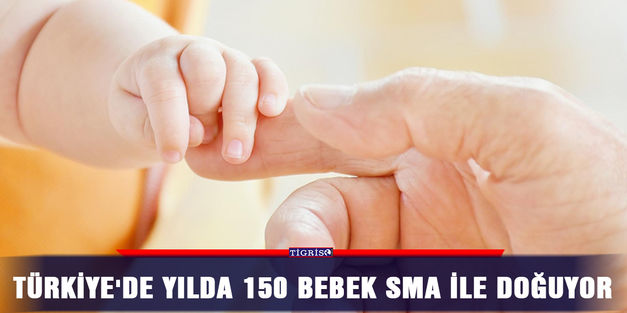Türkiye'de yılda 150 bebek SMA ile doğuyor