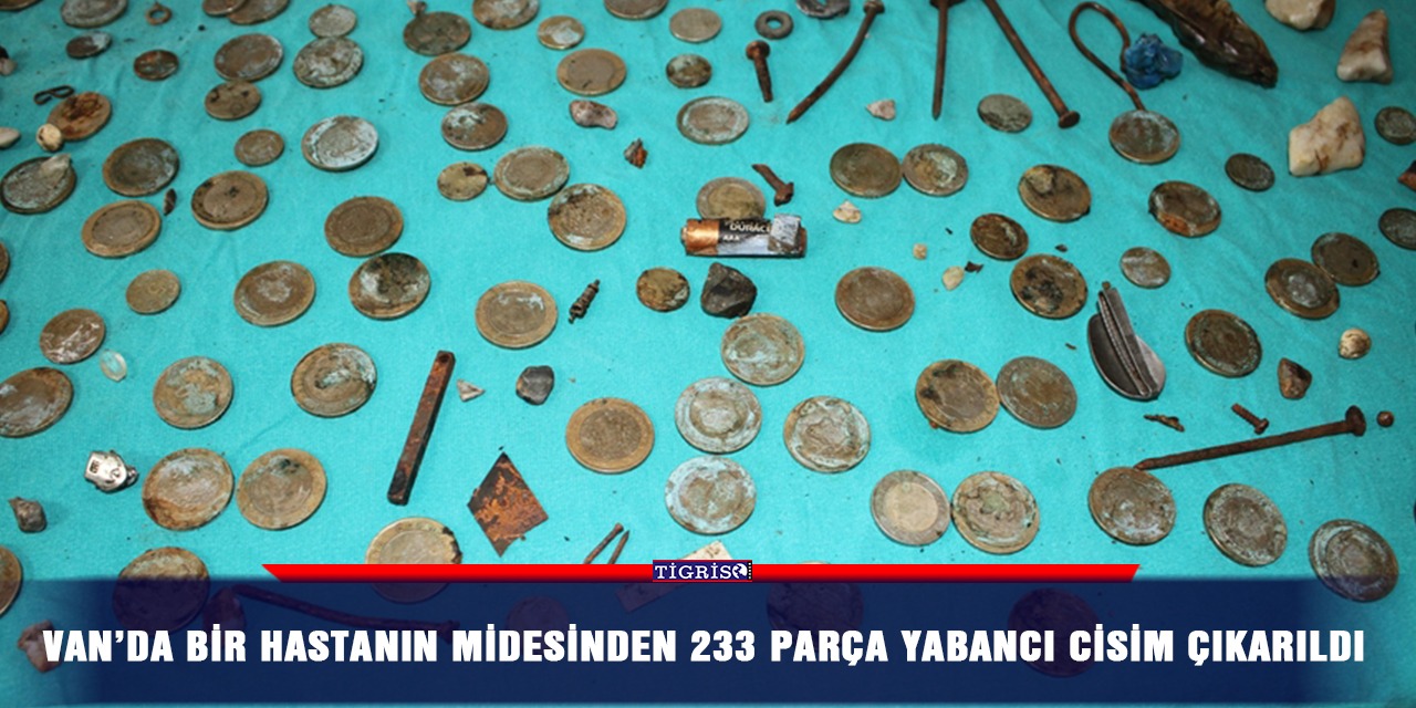 Van’da bir hastanın midesinden 233 parça yabancı cisim çıkarıldı