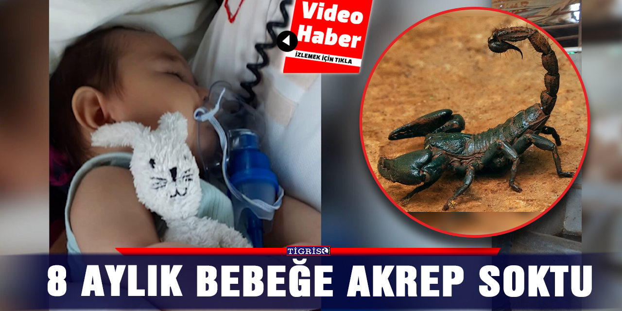 VİDEO - 8 aylık bebeğe akrep soktu