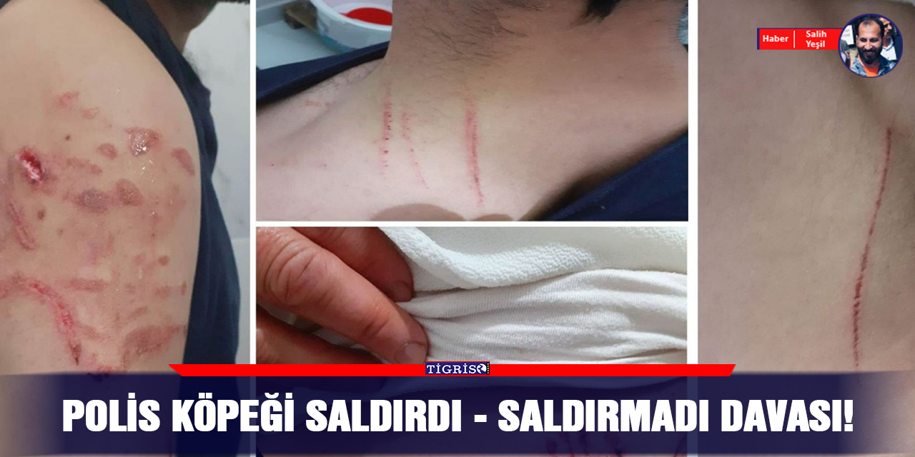Polis köpeği saldırdı - saldırmadı davası!