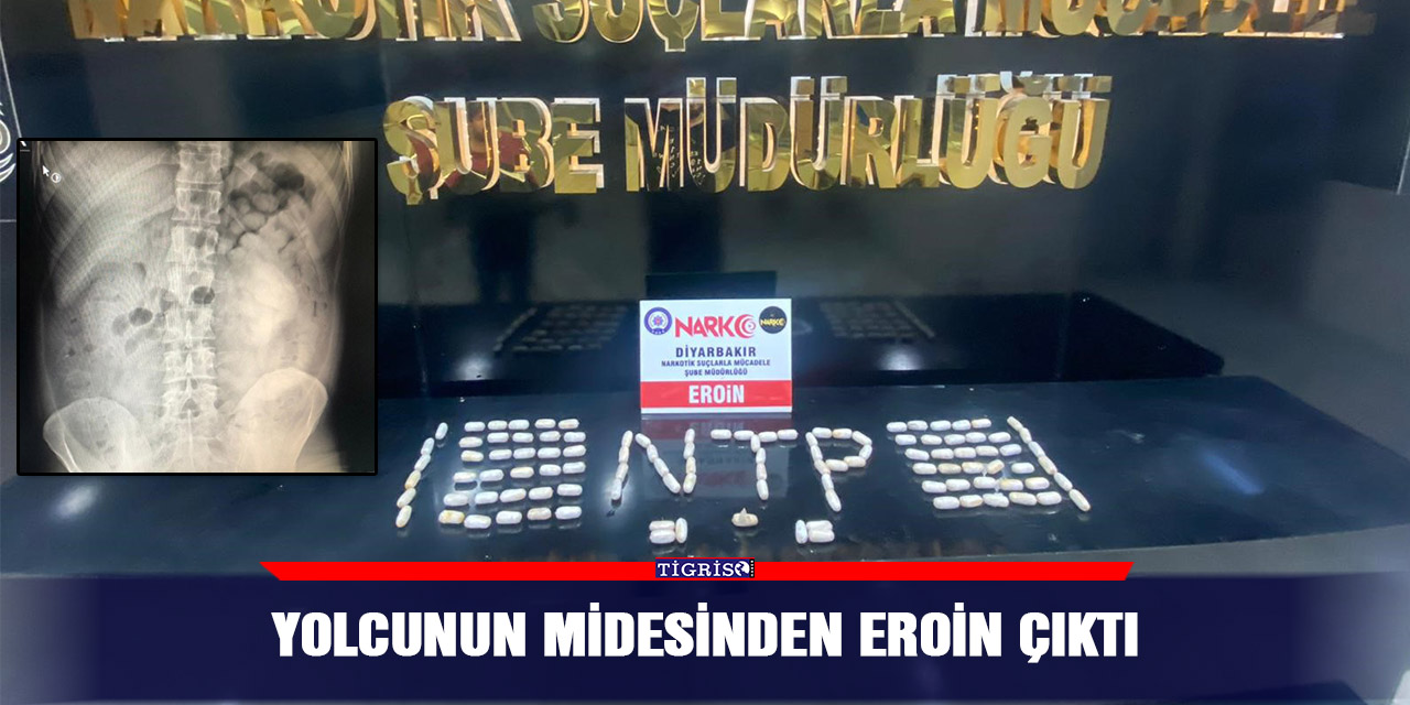 Yolcunun midesinden eroin çıktı