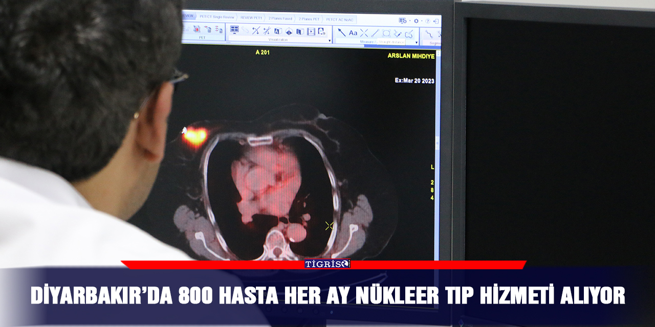 Diyarbakır’da 800 hasta her ay nükleer tıp hizmeti alıyor