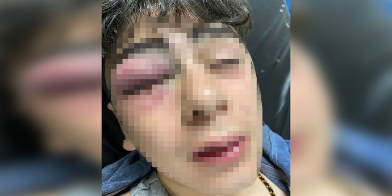 Mahkeme 'işkence suçudur' dedi