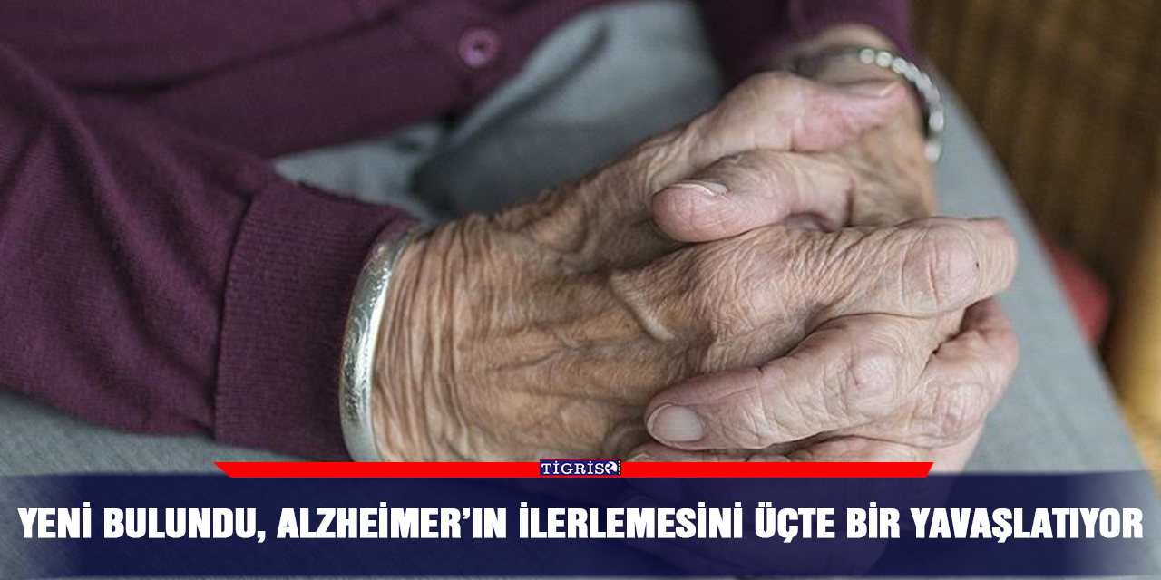 Yeni bulundu, Alzheimer’ın ilerlemesini üçte bir yavaşlatıyor