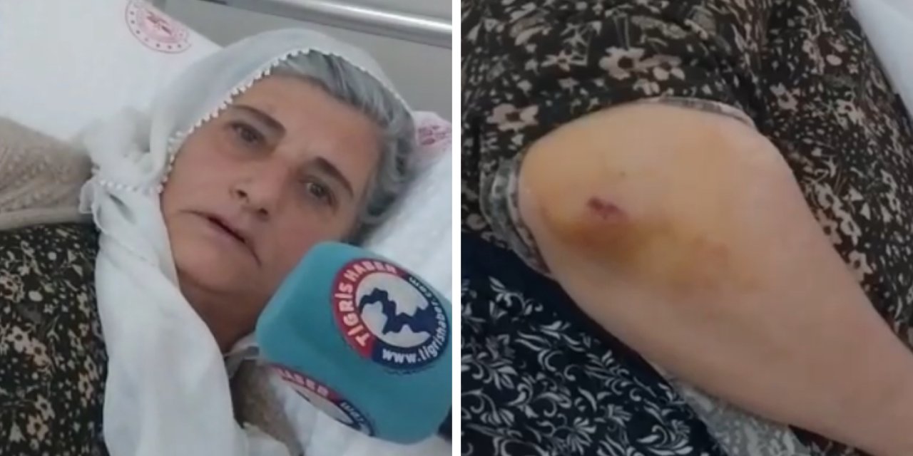 VİDEO - Diyarbakır’da kadına şiddet: DİSKİ personeli beni darp etti!