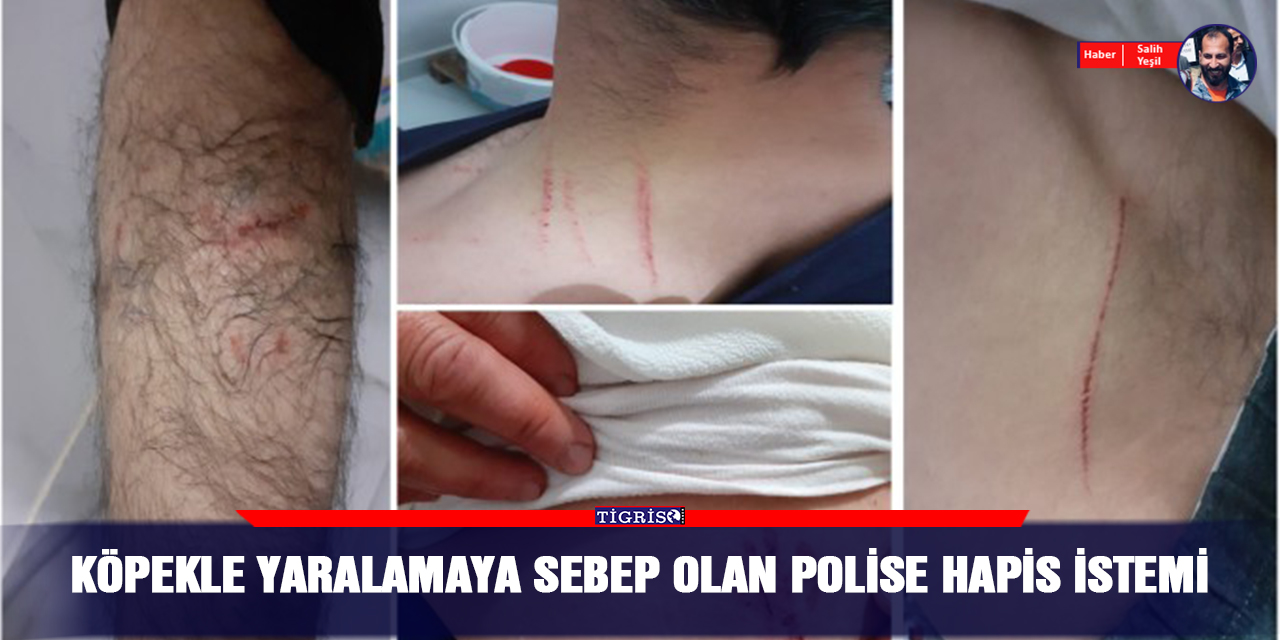 Köpekle yaralamaya sebep olan polise hapis istemi