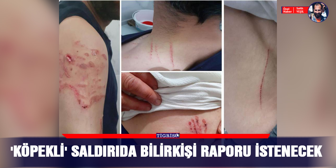 'Köpekli' saldırıda bilirkişi raporu istenecek