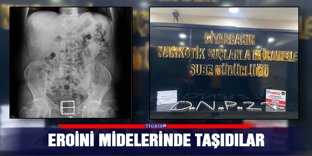 Eroini midelerinde taşıdılar