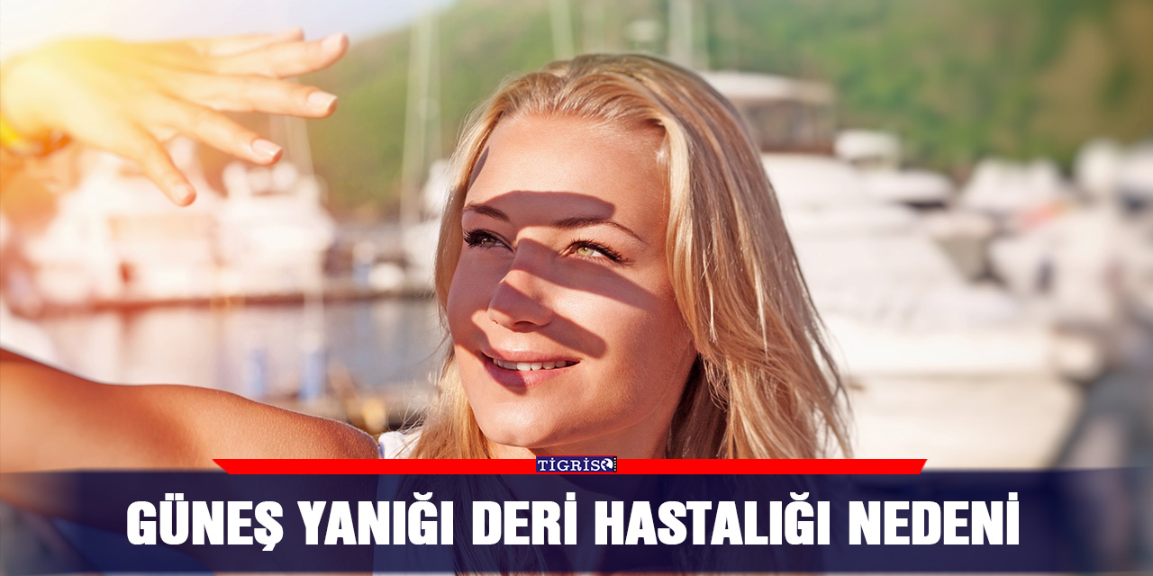 Güneş yanığı deri hastalığı nedeni