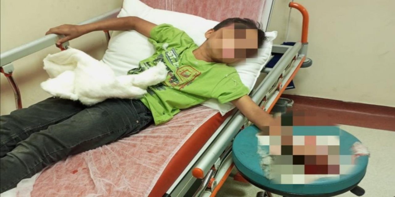 Parmağını sıkıştırınca imdadına itfaiye yetişti