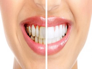 Dişlerinizi peynirle temizleyin