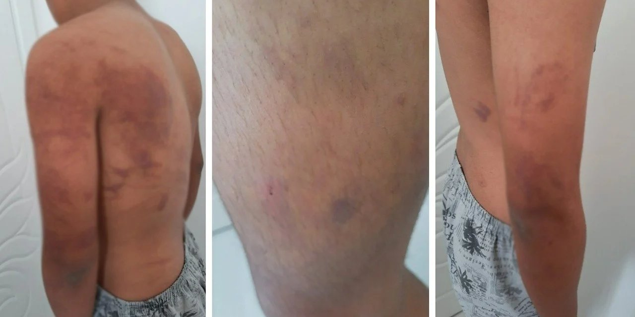 İşkenceci baba ve amca tutuklandı