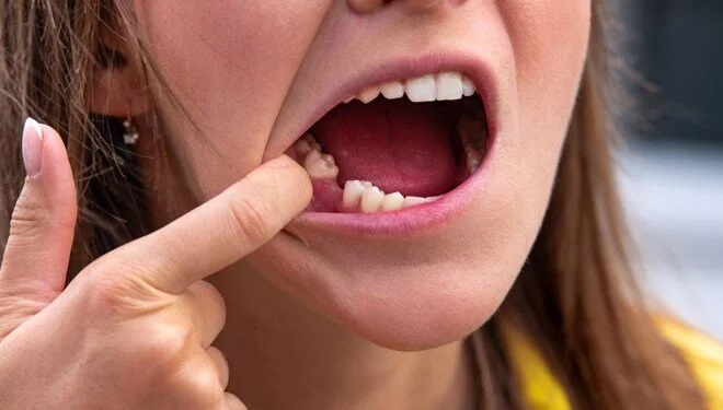 Japonlar dişleri yeniden çıkaracak ilacı buldu