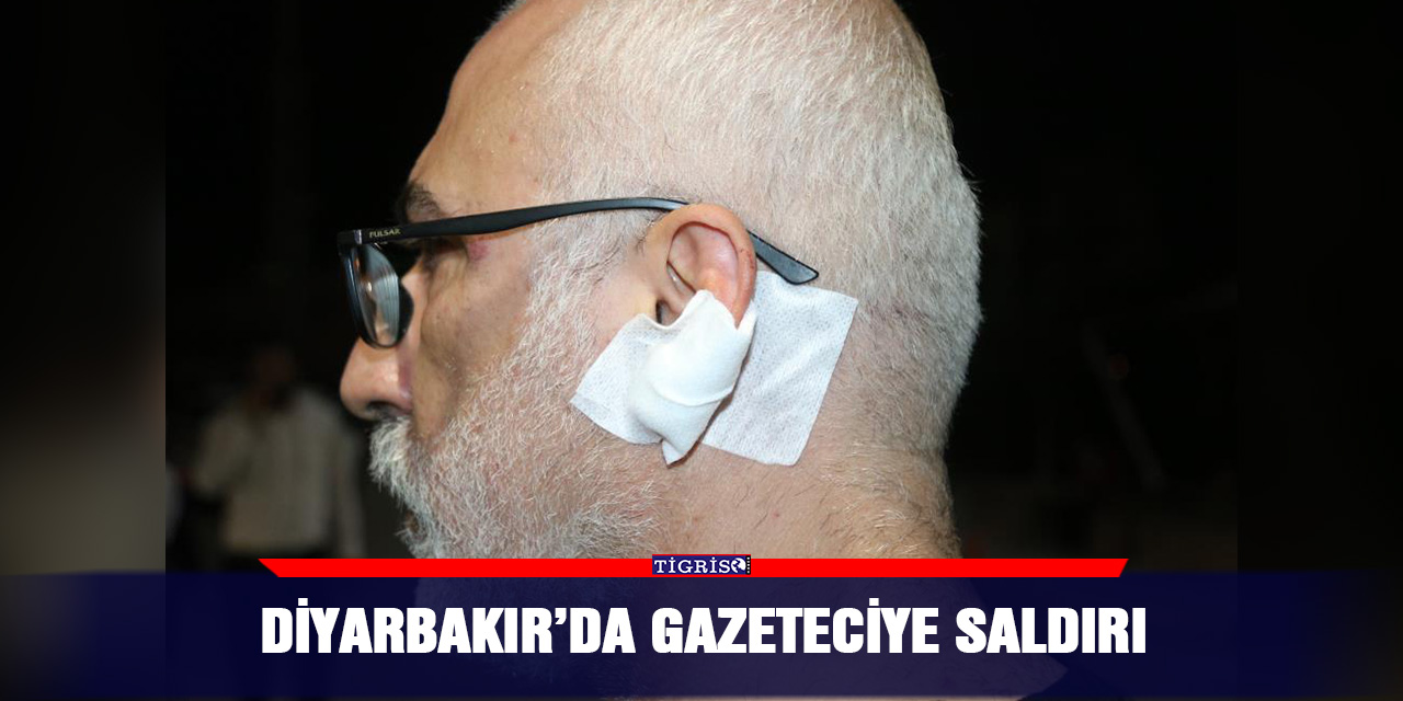 Diyarbakır’da gazeteciye saldırı