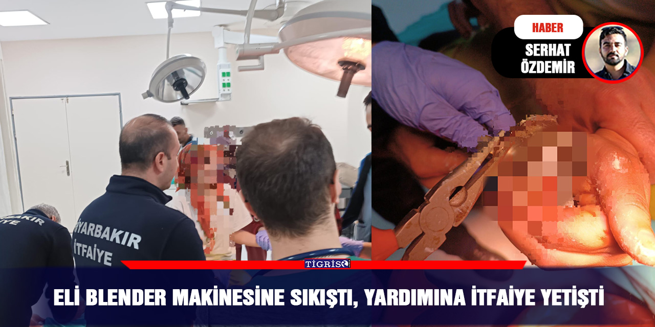 Eli blender makinesine sıkıştı, yardımına itfaiye yetişti