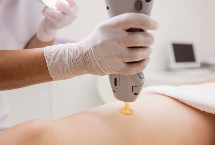 Lazer epilasyon zararları