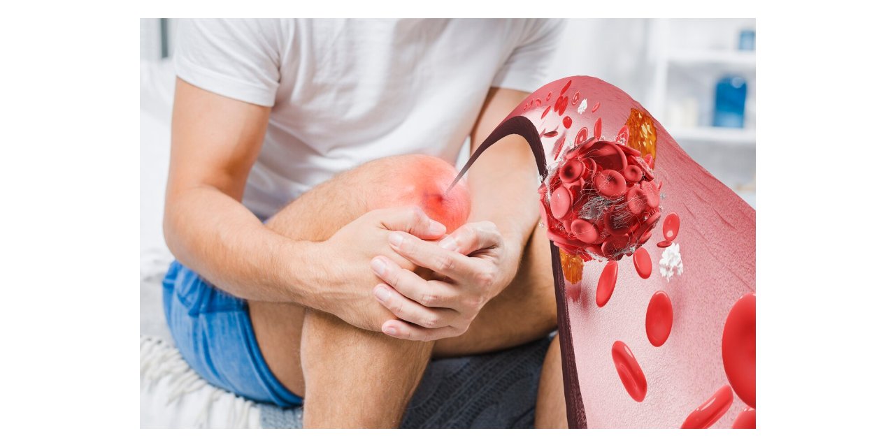 DİZ VE DİRSEK KARARMALARINA DOĞAL ÇÖZÜMLER