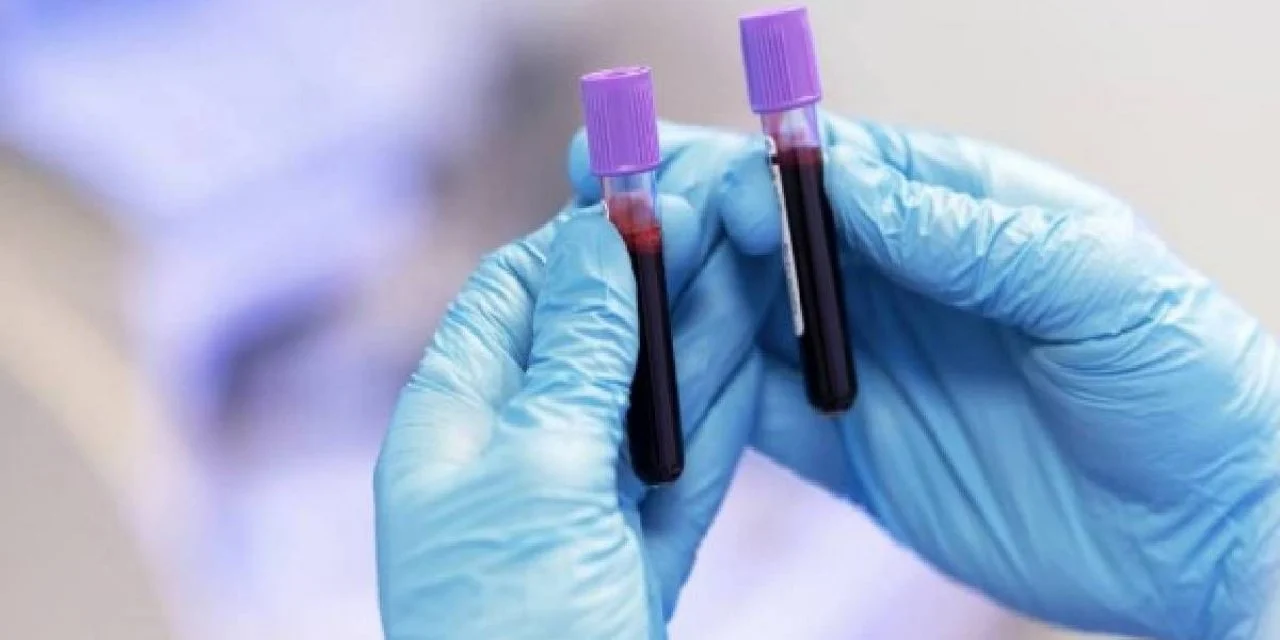 İşte en zeki kan grubu