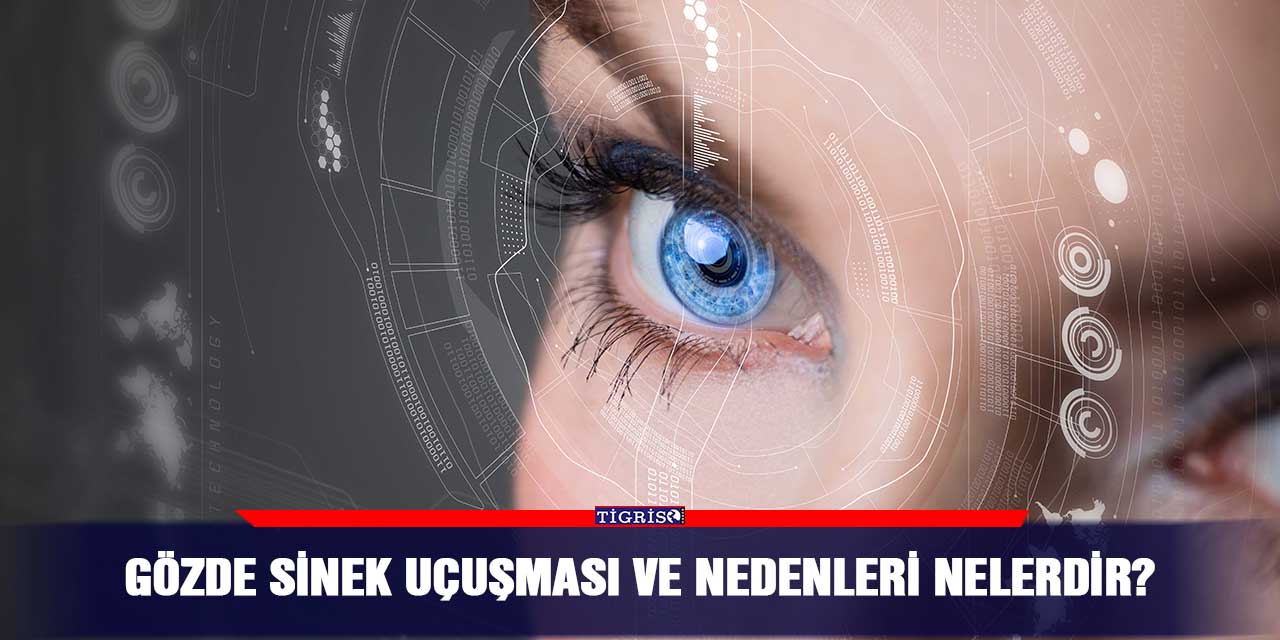 Gözde sinek uçuşması ve nedenleri nelerdir?