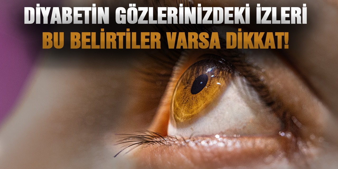 Diyabetin Gözlerinizdeki İzleri: Yükselen Kan Şekerinin İşareti