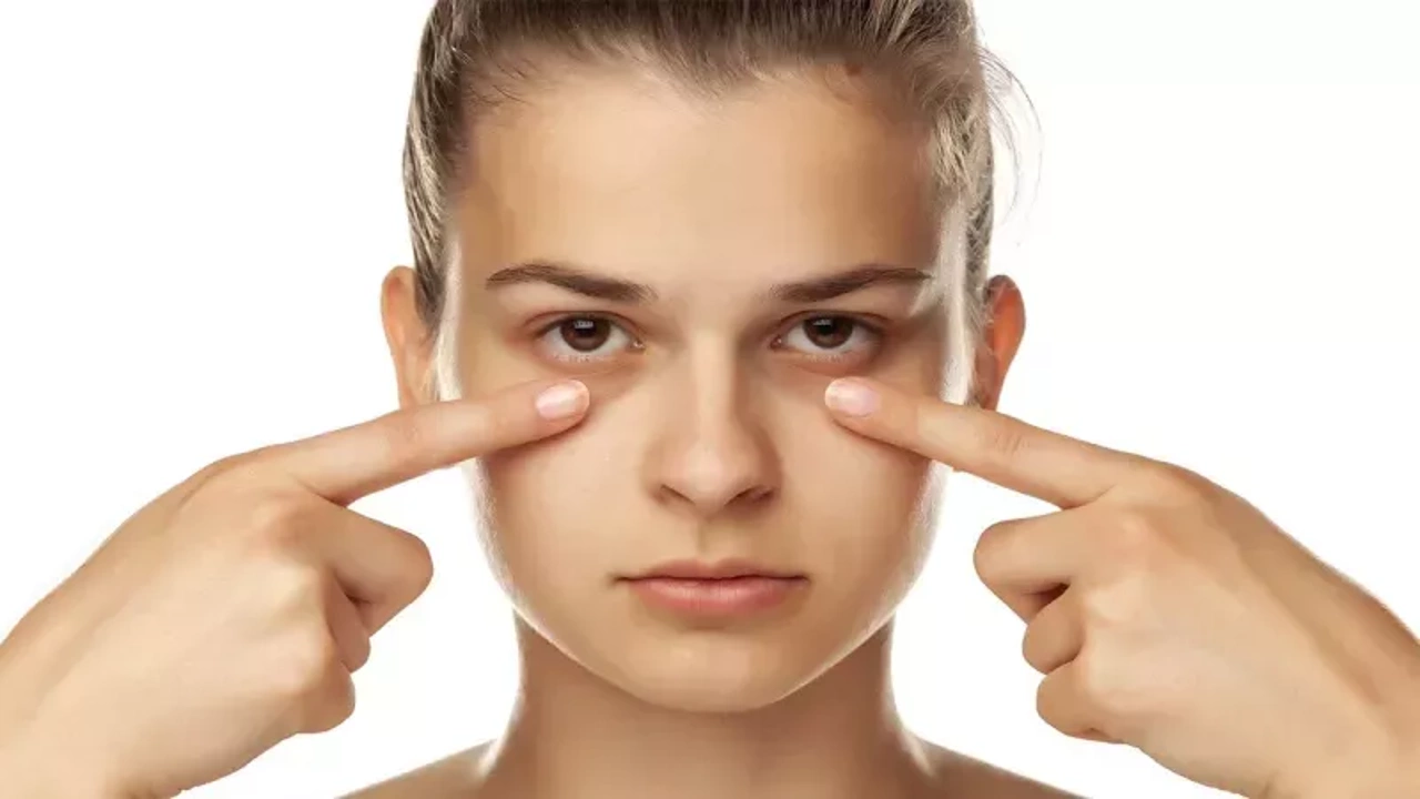 Doğal Yöntemlerle Göz Altı Morluklarına Veda Edin