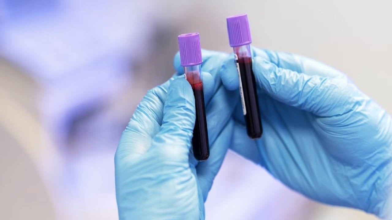 Hangi kan grubu daha uzun yaşamayı sağlıyor?