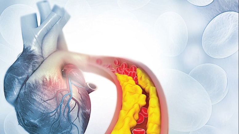 Kolesterolü İlaçsız Azaltmanın Doğal Yolları
