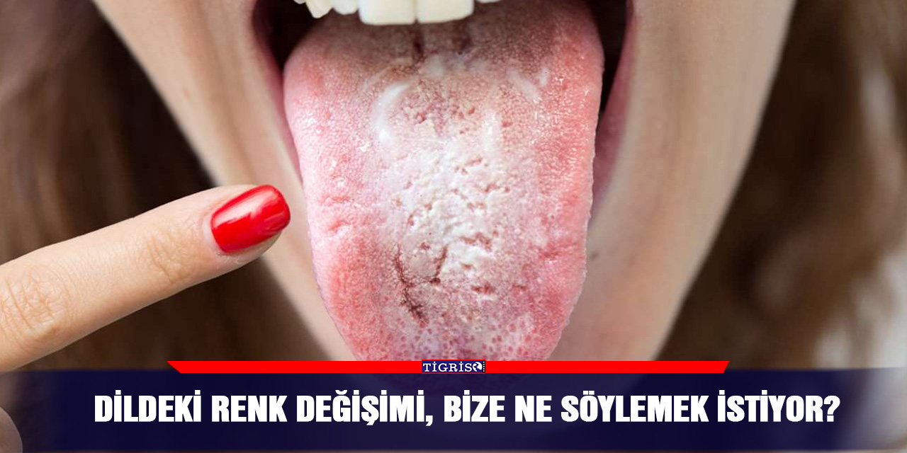 Dildeki renk değişimi, bize ne söylemek istiyor?