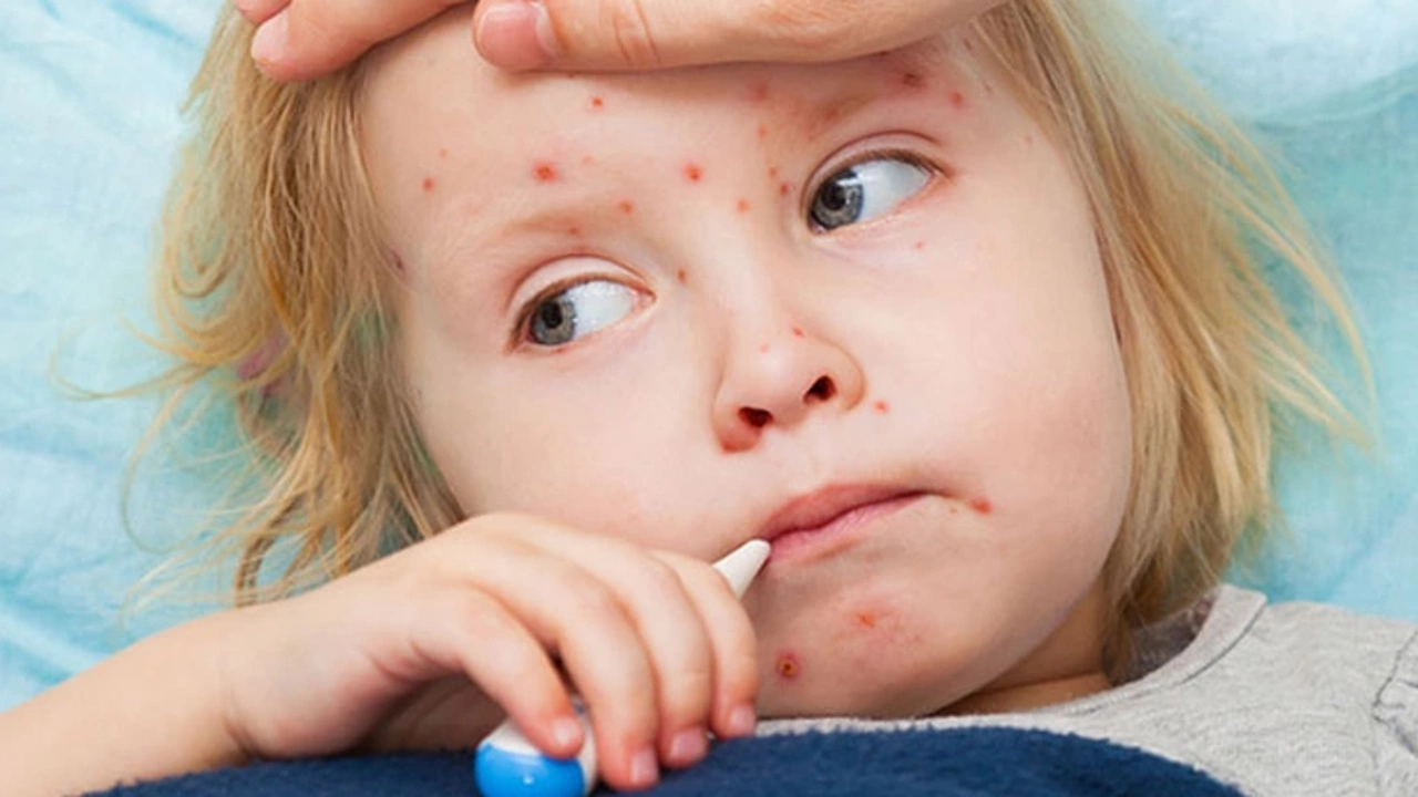 Kızamık hastalığı nedir?