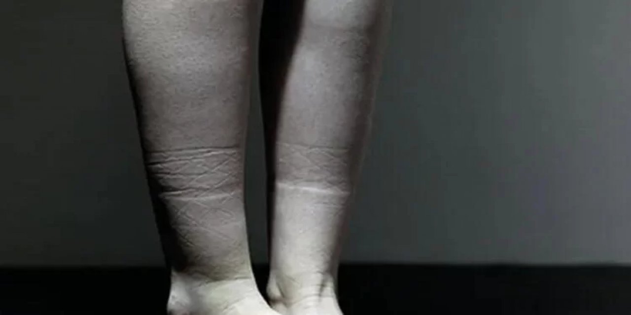 Çorap izi, sandığınız kadar masum olmayabilir!