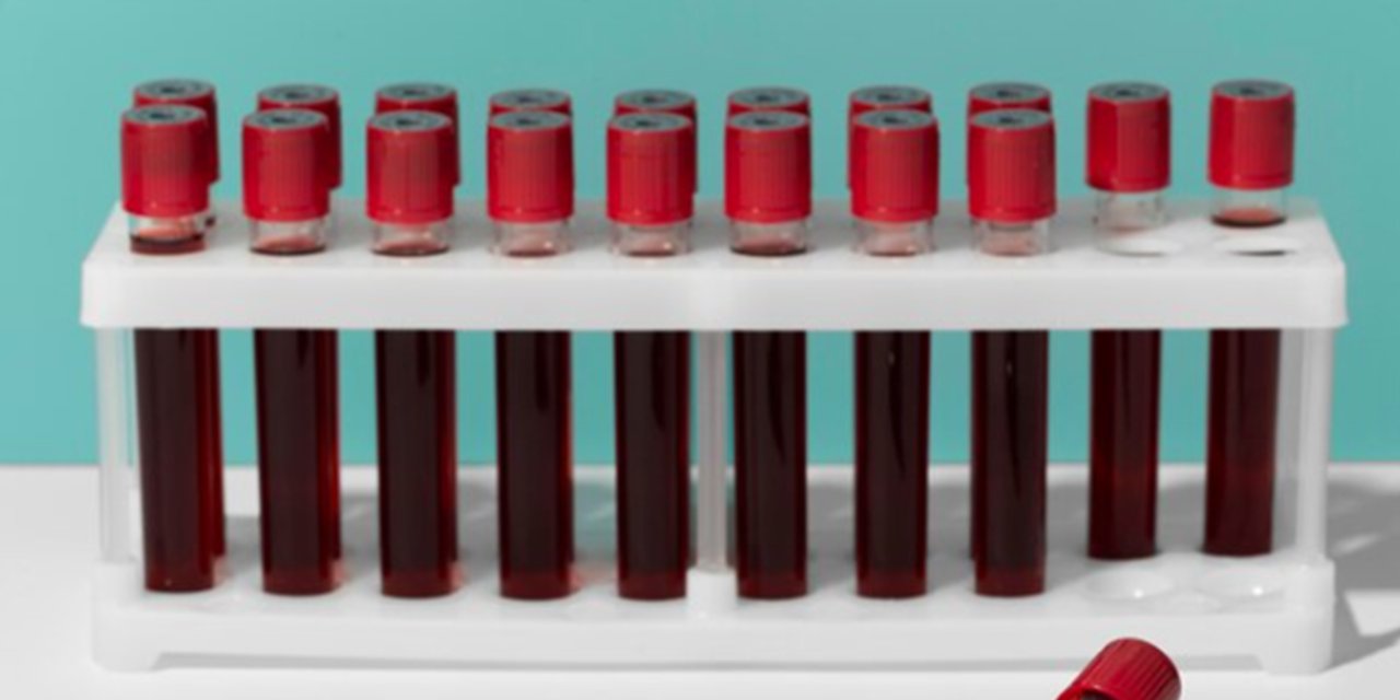 Kan grubunuzun sırları: Kan grubunu bilen herkesi ilgilendiriyor!