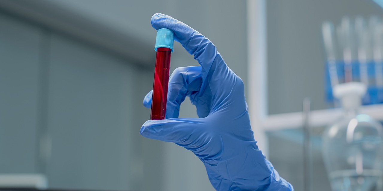 AB kan grubu olanlar için uyarı!