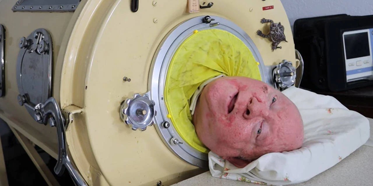 'Demir Akciğerli Adam' hayatını kaybetti