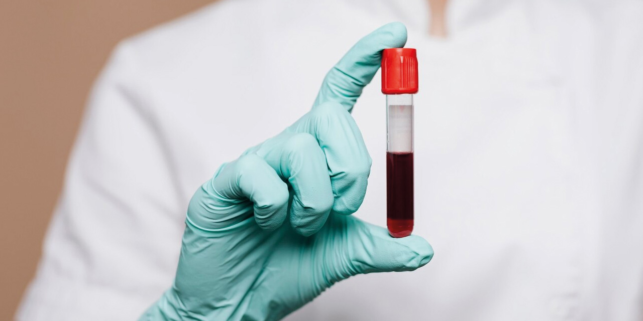 En duygusal kan grubu belli oldu