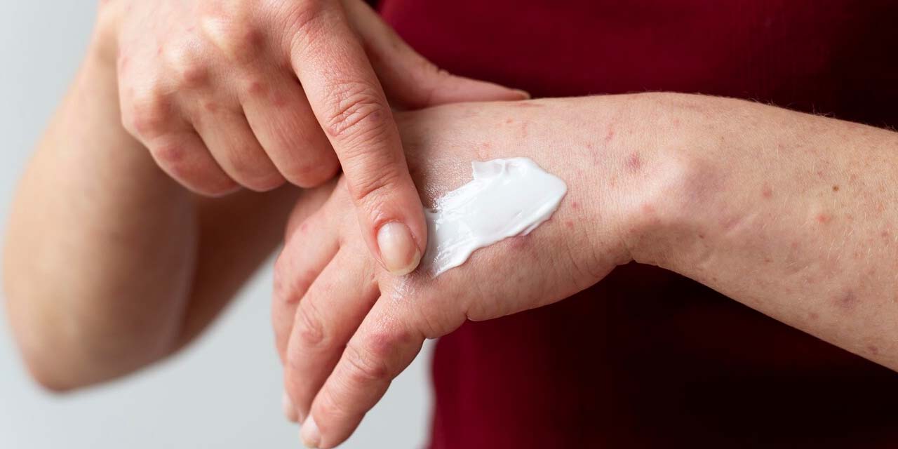 Yaranın üstüne döküldüğünde anında etki ediyor!