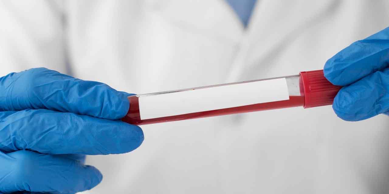 Bu kan grupları diğer kan gruplarına göre daha uzun yaşıyorlar