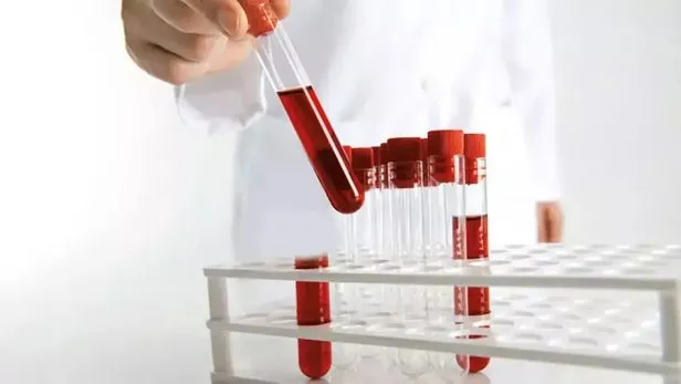 Kan grubunu bilen herkesi ilgilendiriyor!