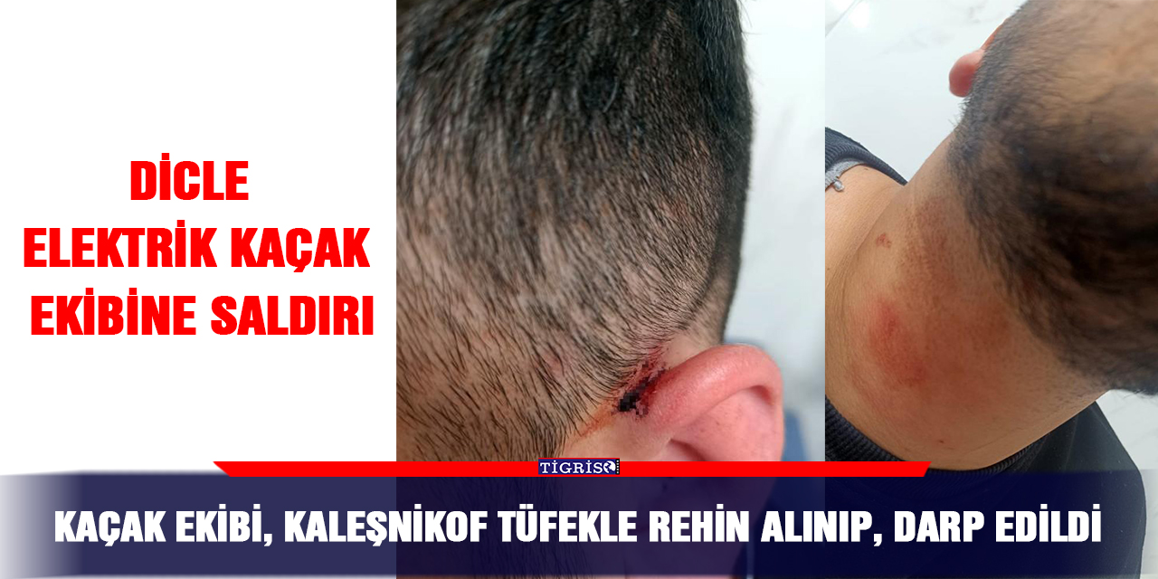 Dicle Elektrik kaçak ekibine saldırı