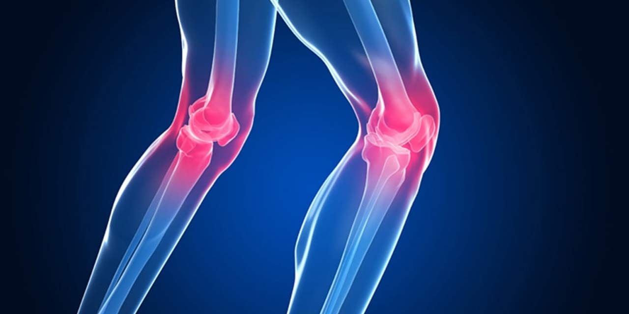 Dizlerinizdeki Sessiz Tehlike Hakkında Bilmeniz Gereken Gerçekler!