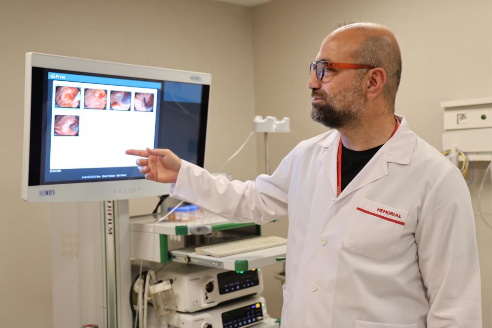 Kolanjiyoskop yöntemiyle dokudan biyopsi alındı