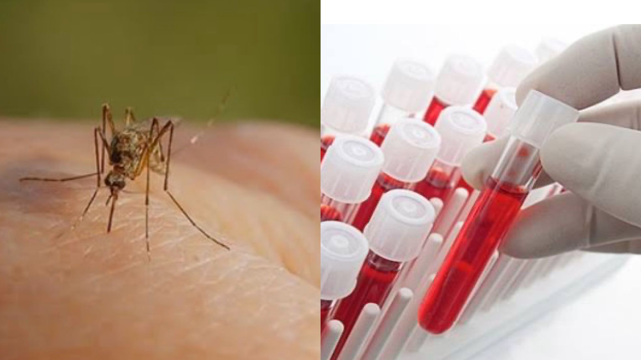 Sivrisinekler en çok hangi kan gruplarını seviyor?