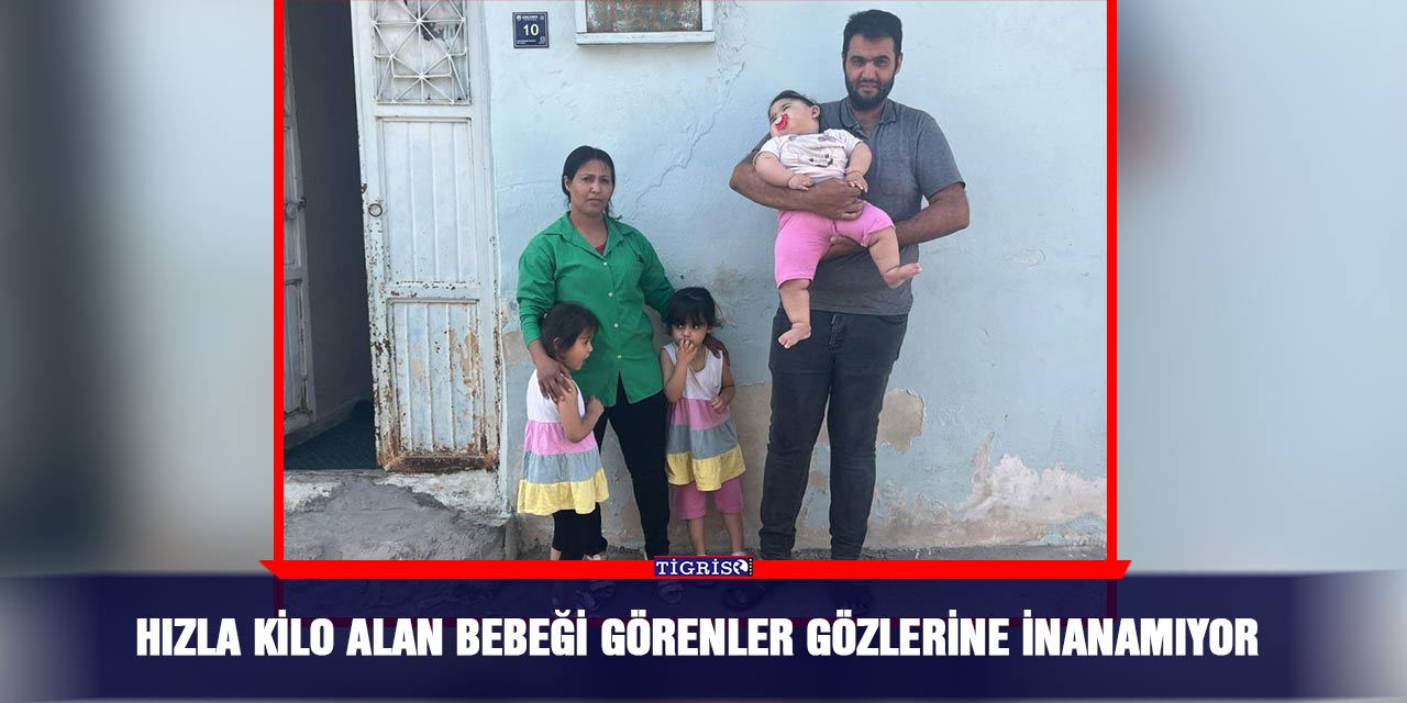 Hızla kilo alan bebeği görenler gözlerine inanamıyor