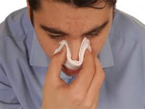 Fazla güneş bakın neye sebep oluyor?